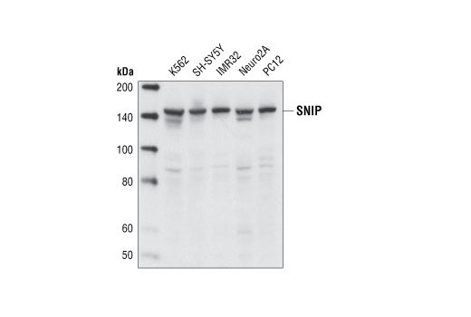 Western Blotting Image 1: SNIP/p140Cap Antibody