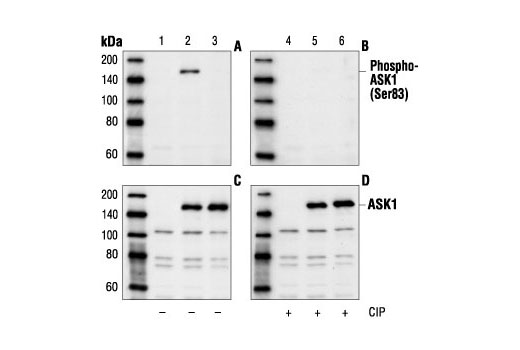 Western Blotting Image 1: Phospho-ASK1 (Ser83) Antibody