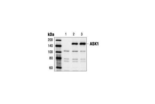 Western Blotting Image 1: ASK1 Antibody