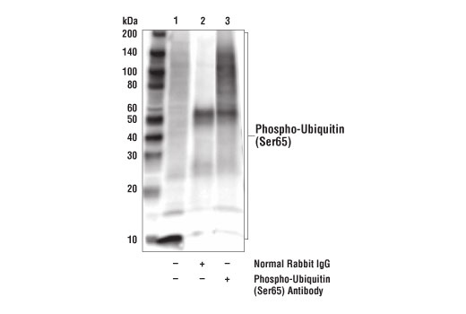 Immunoprecipitation Image 1: Phospho-Ubiquitin (Ser65) Antibody