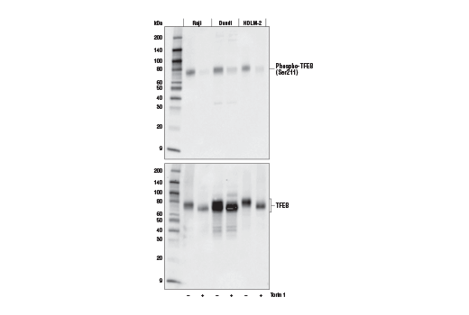  Image 1: PhosphoPlus® TFEB (Ser211) Antibody Duet