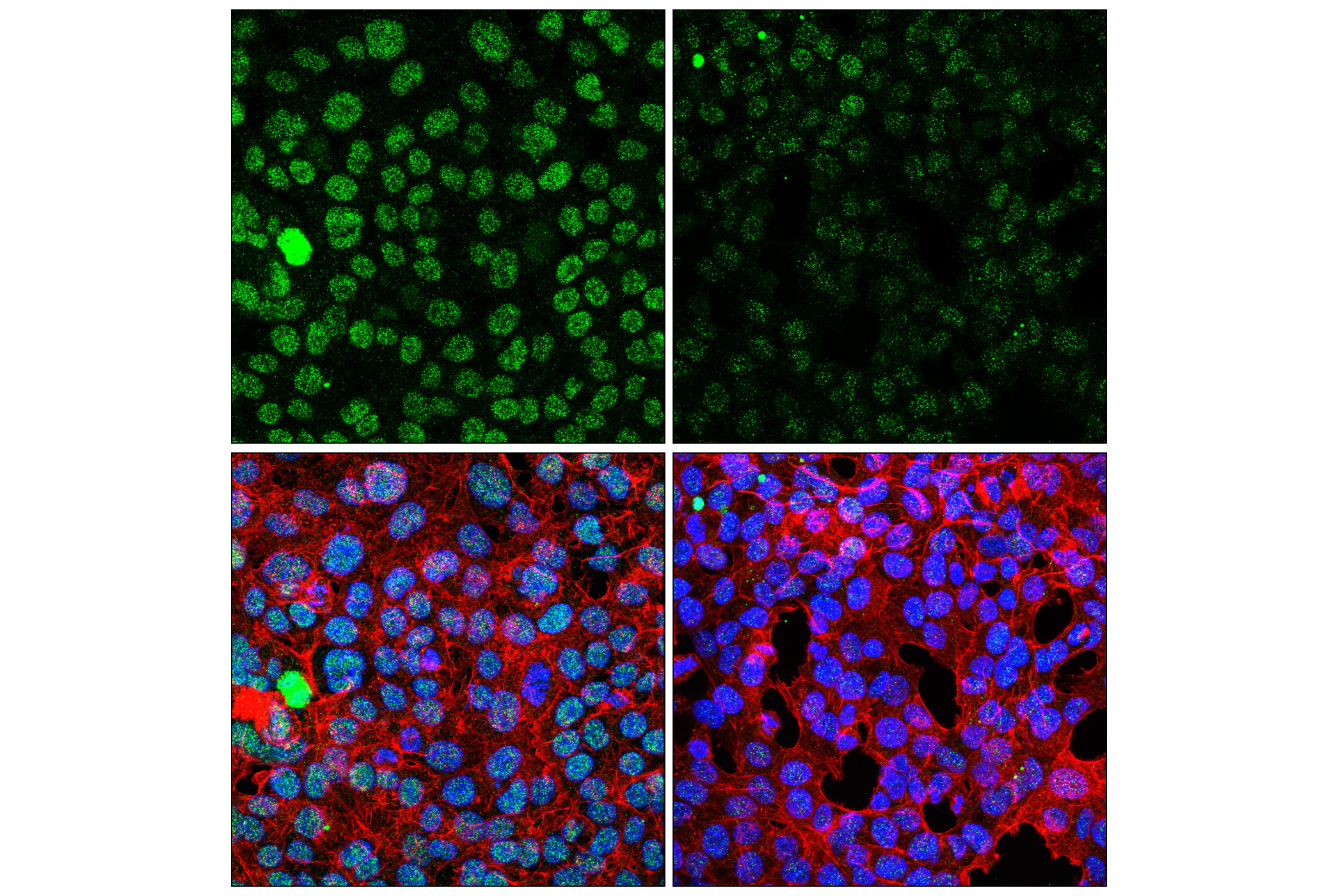 Immunofluorescence Image 1: BRD4 Isoform C (E1Q9N) Rabbit Monoclonal Antibody (BSA and Azide Free)