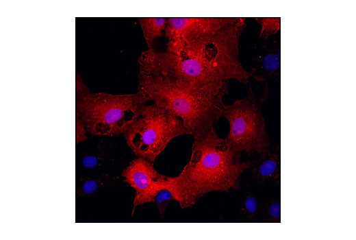 Immunofluorescence Image 1: DYKDDDDK Tag Antibody (Binds to same epitope as Sigma's Anti-FLAG® M2 Antibody) (Alexa Fluor® 555 Conjugate)