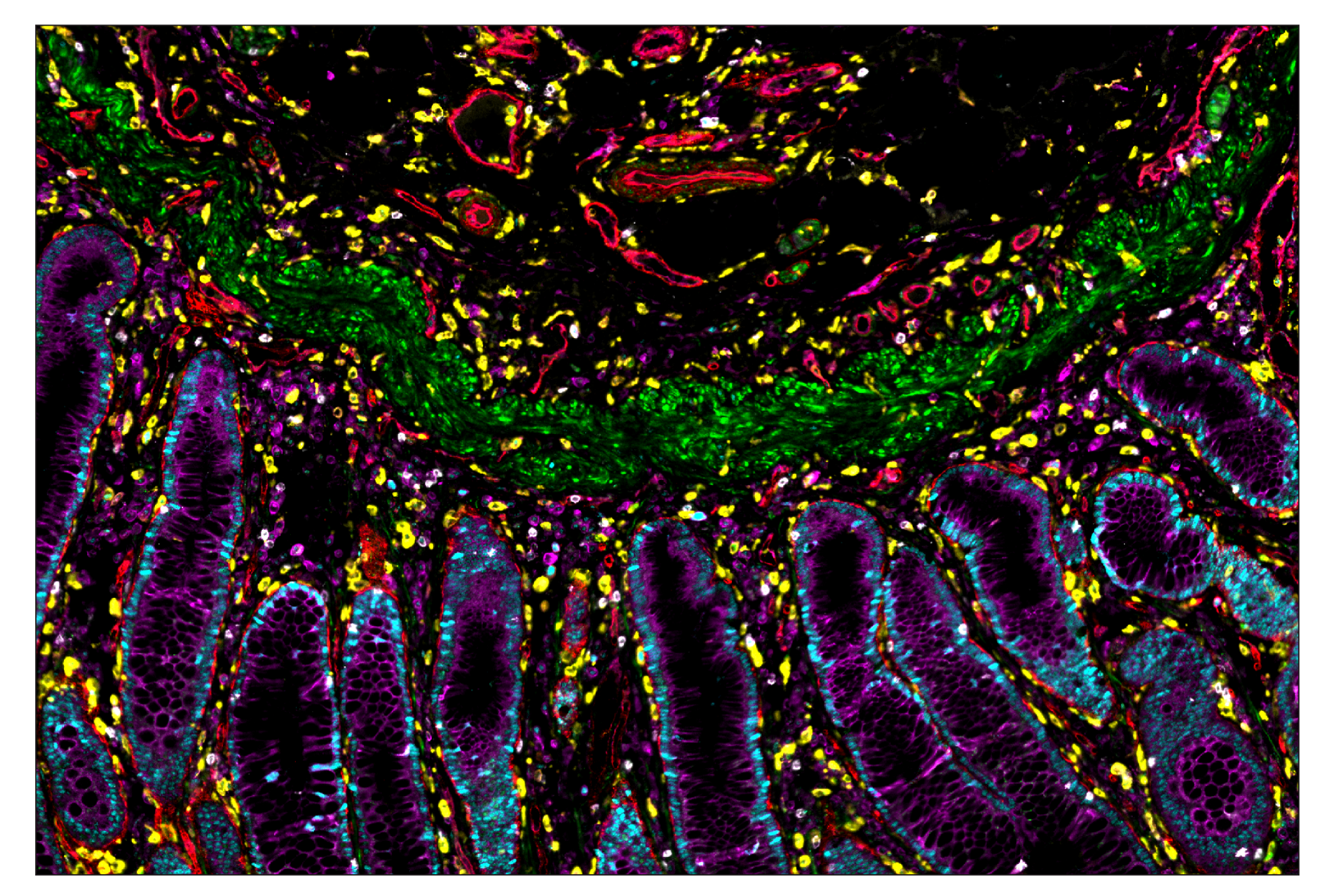 Immunohistochemistry Image 5: PCNA (D3H8P) & CO-0090-647 SignalStar™ Oligo-Antibody Pair