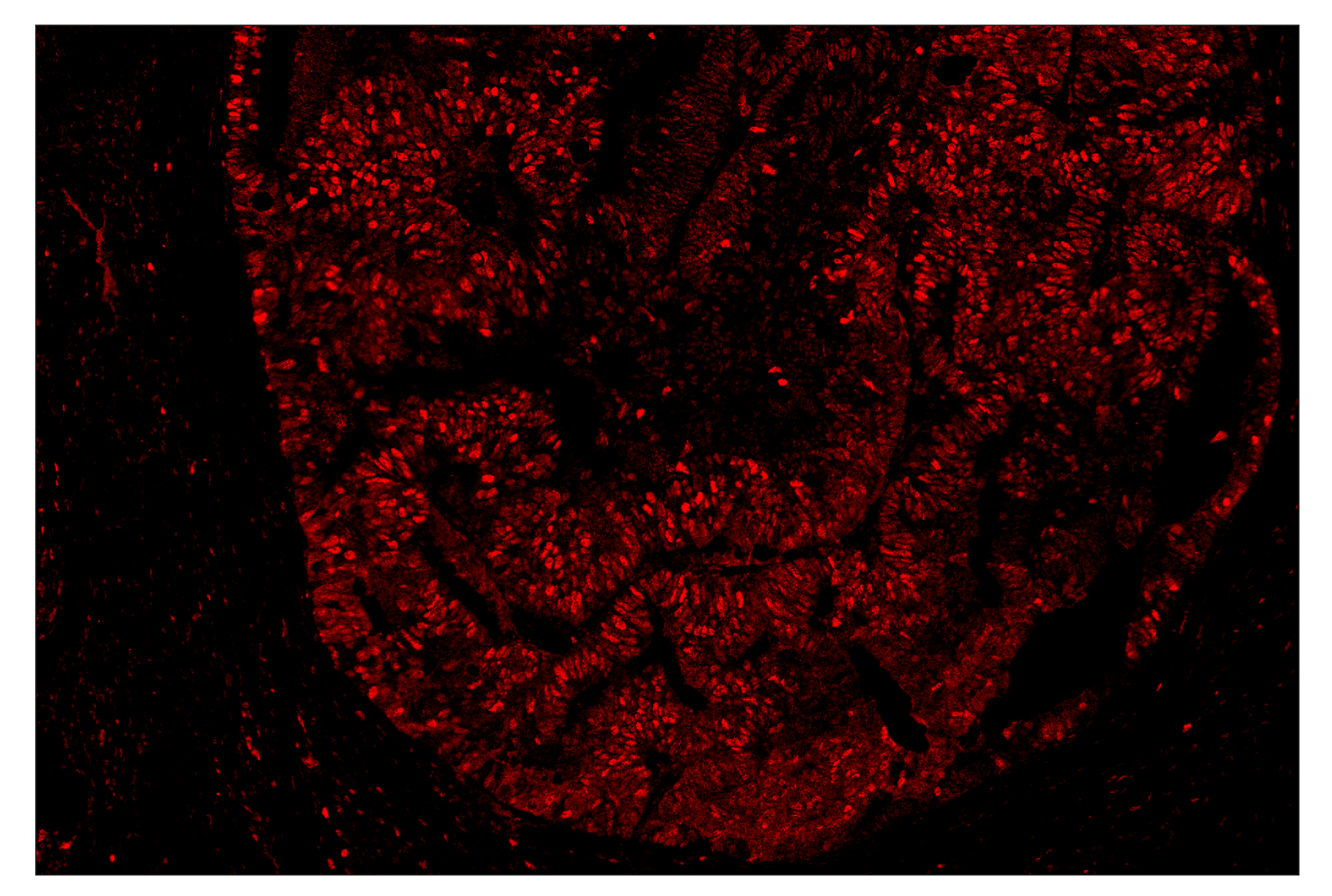 Immunohistochemistry Image 6: PCNA (D3H8P) & CO-0090-647 SignalStar™ Oligo-Antibody Pair