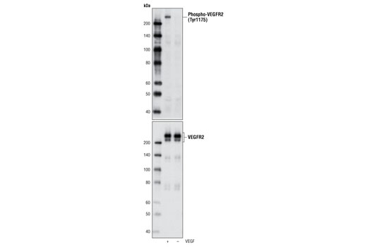  Image 2: Phospho-VEGF Receptor 2 Antibody Sampler Kit