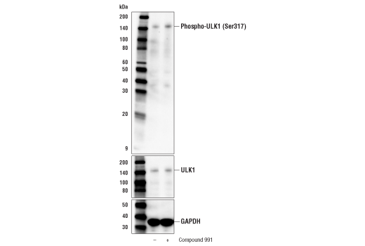 Western Blotting Image 2: Phospho-ULK1 (Ser317) Antibody