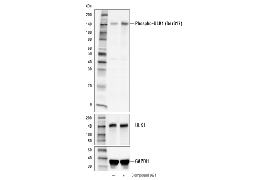 Western Blotting Image 3: Phospho-ULK1 (Ser317) Antibody