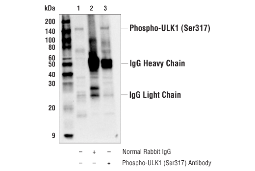 Immunoprecipitation Image 1: Phospho-ULK1 (Ser317) Antibody
