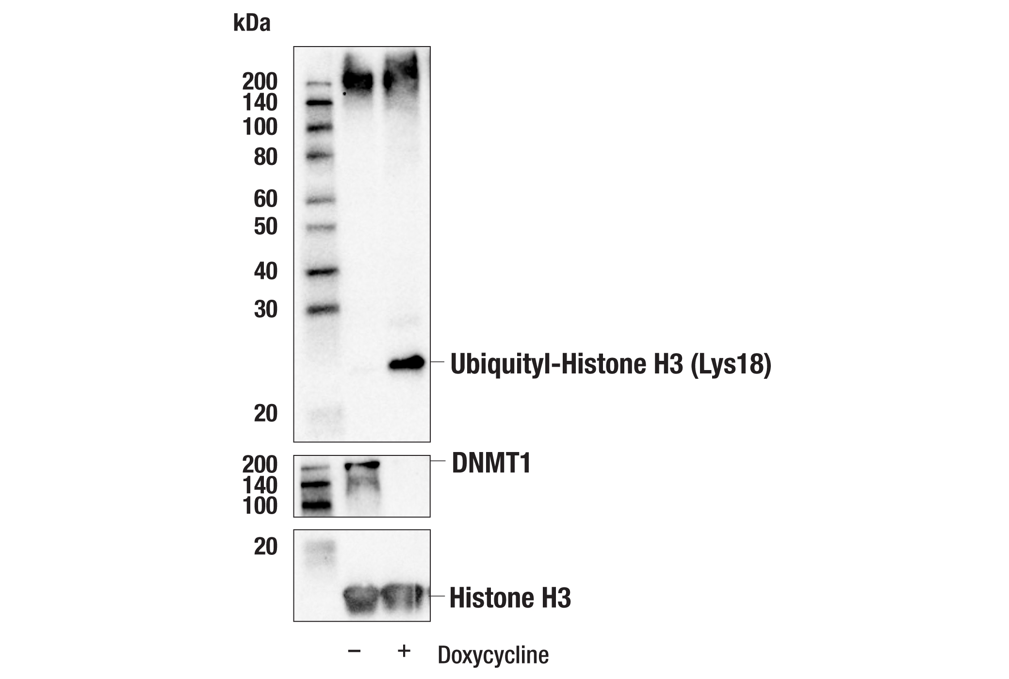 Western Blotting Image 1: Ubiquityl-Histone H3 (Lys18) (E4D7R) Rabbit mAb