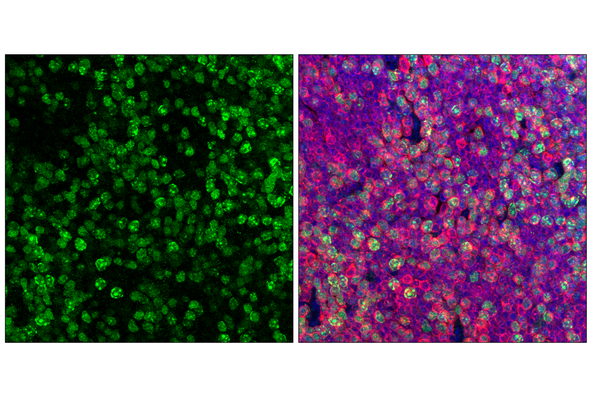 Immunofluorescence Image 1: Ubiquityl-Histone H3 (Lys18) (E4D7R) Rabbit mAb