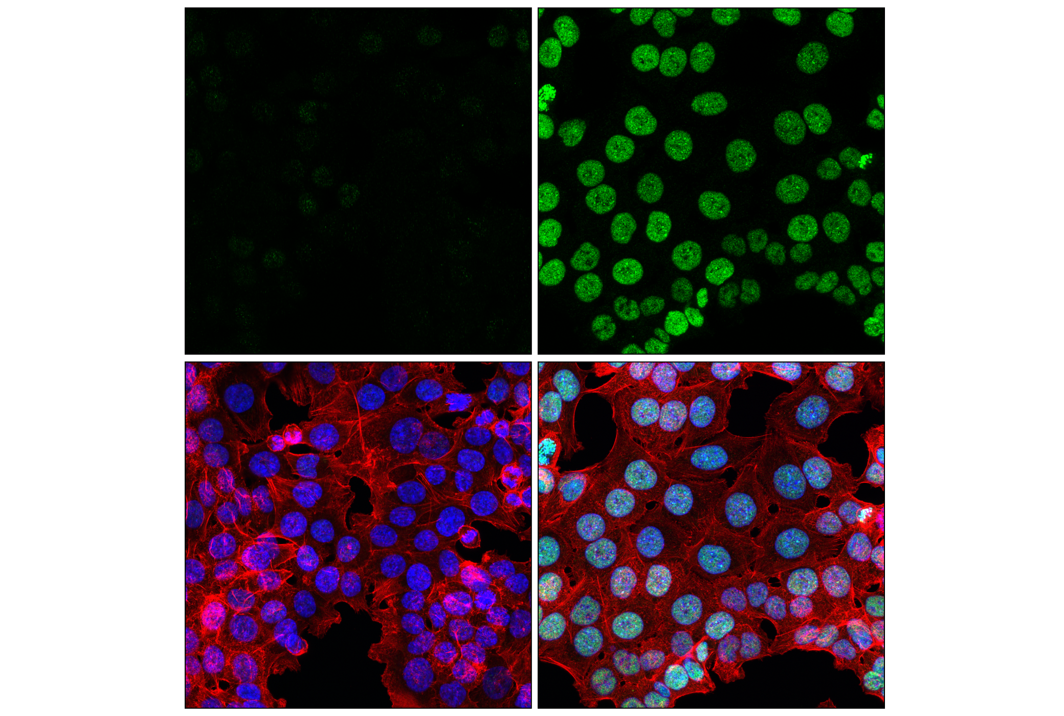 Immunofluorescence Image 2: Ubiquityl-Histone H3 (Lys18) (E4D7R) Rabbit mAb