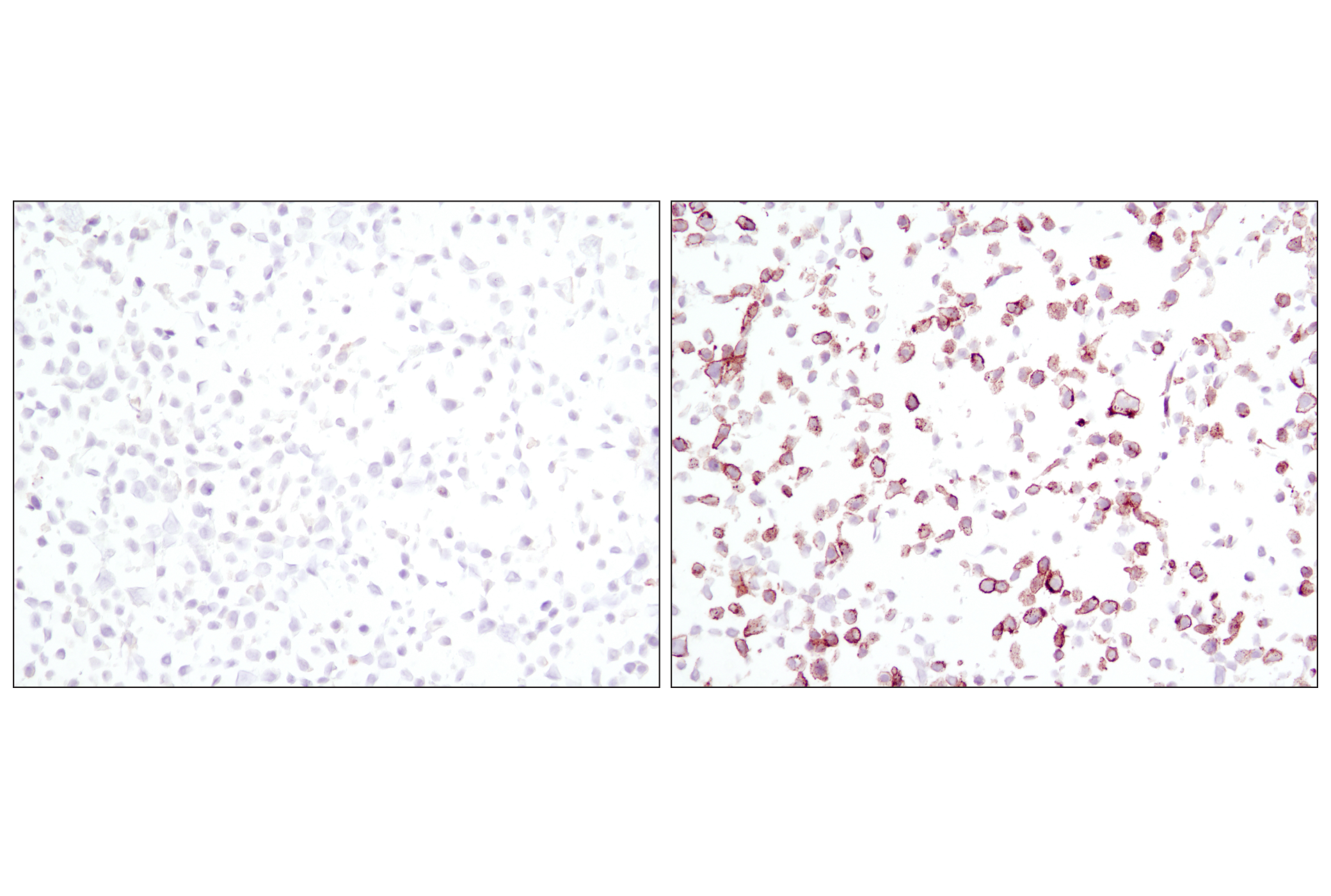  Image 8: PhosphoPlus® EGFR (Tyr1068) Antibody Duet