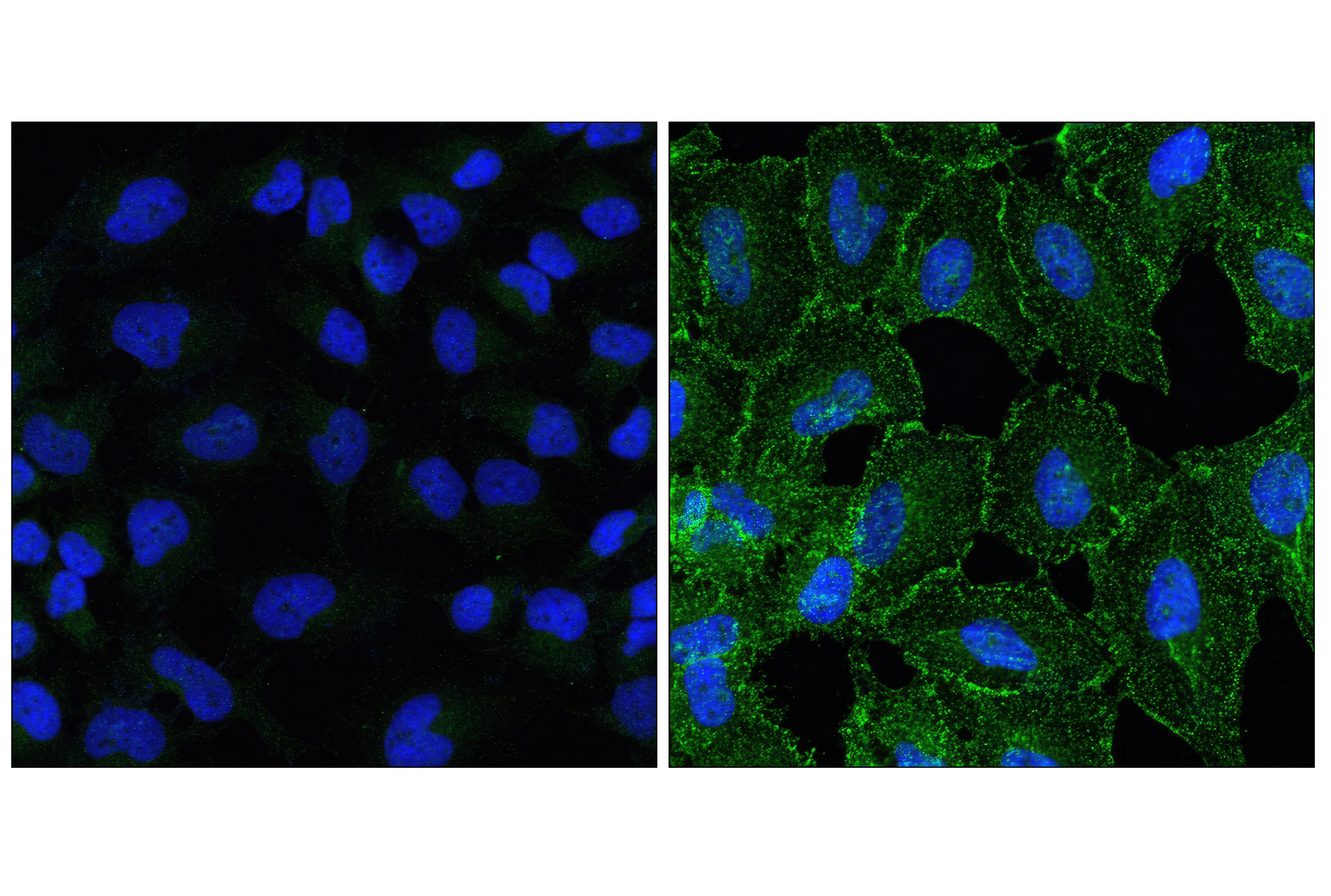 Immunofluorescence Image 1: Phospho-EGF Receptor (Tyr1068) (D7A5) XP® Rabbit mAb