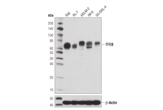  Image 2: PhosphoPlus® TFEB (Ser211) Antibody Duet