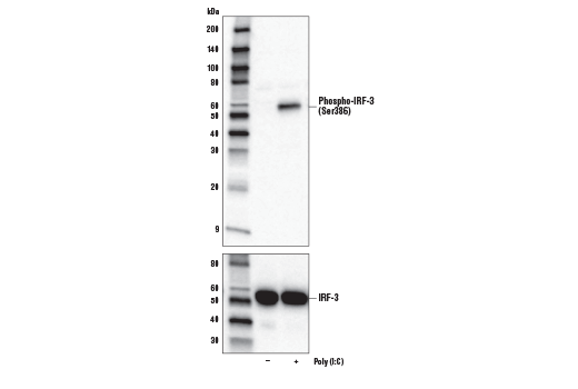  Image 8: Type I Interferon Induction and Signaling Antibody Sampler Kit
