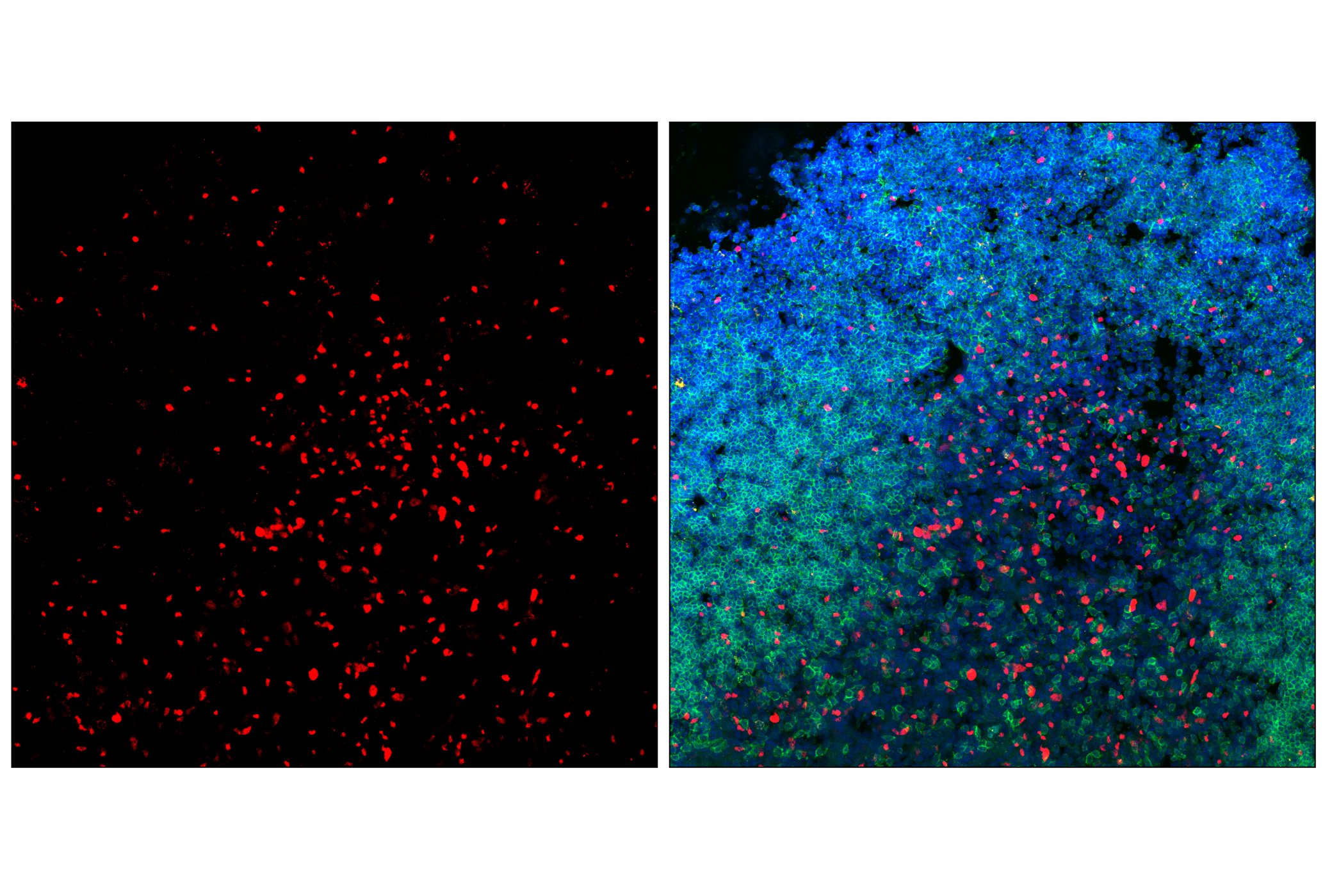 Immunofluorescence Image 1: T-bet/TBX21 (E4I2K) Rabbit mAb (Alexa Fluor® 647 Conjugate)