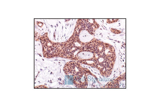 Immunohistochemistry Image 1: Phospho-Akt (Ser473) (736E11) Rabbit mAb