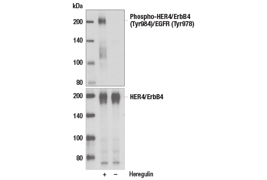Western Blotting Image 1: Phospho-HER4/ErbB4 (Tyr984)/EGFR (Tyr978) Antibody