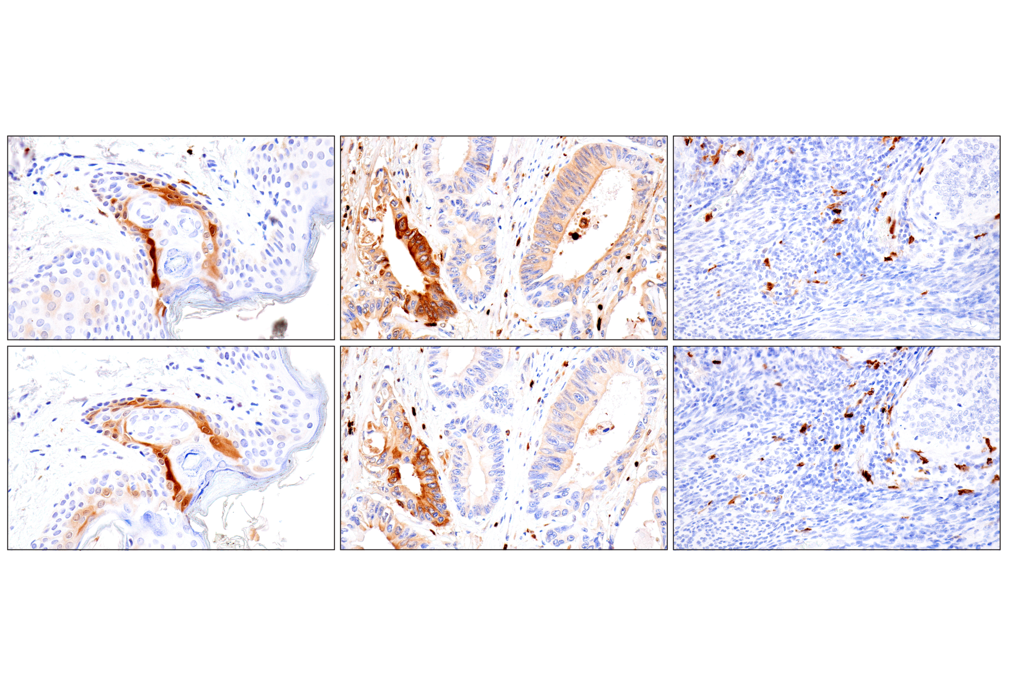 Immunohistochemistry Image 10: S100A8 (F4R2W) Rabbit mAb (BSA and Azide Free)
