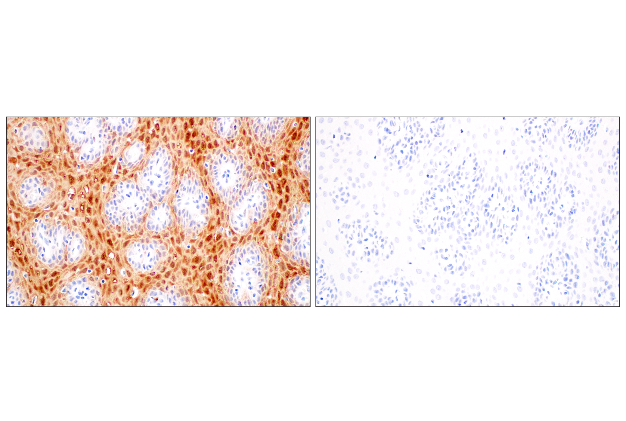 Immunohistochemistry Image 11: S100A8 (F4R2W) Rabbit mAb (BSA and Azide Free)