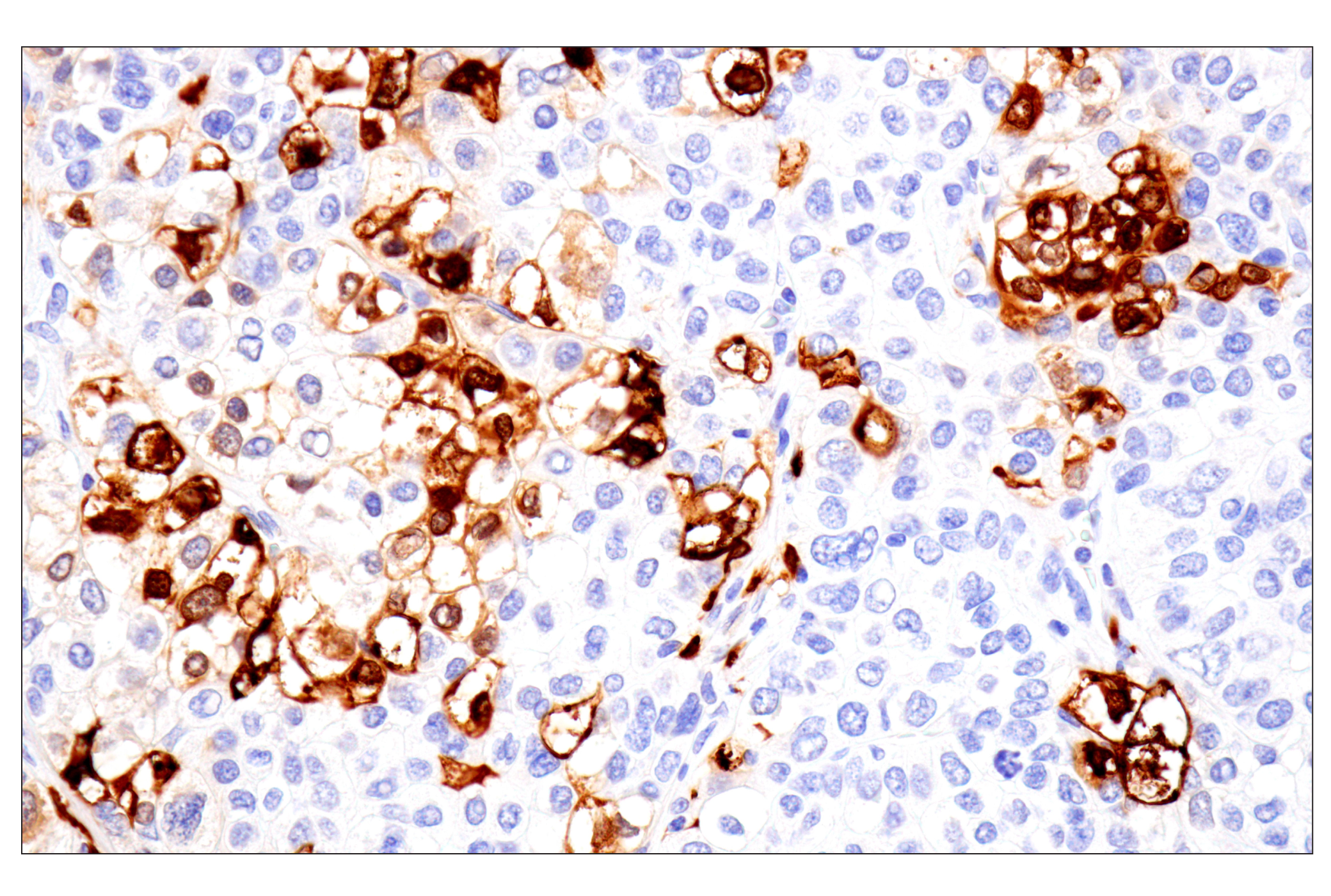 Immunohistochemistry Image 3: S100A8 (F4R2W) Rabbit mAb (BSA and Azide Free)