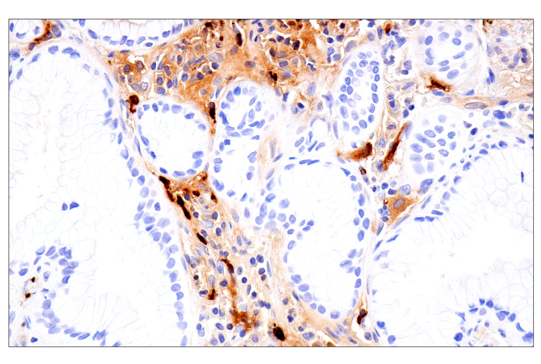 Immunohistochemistry Image 4: S100A8 (F4R2W) Rabbit mAb (BSA and Azide Free)