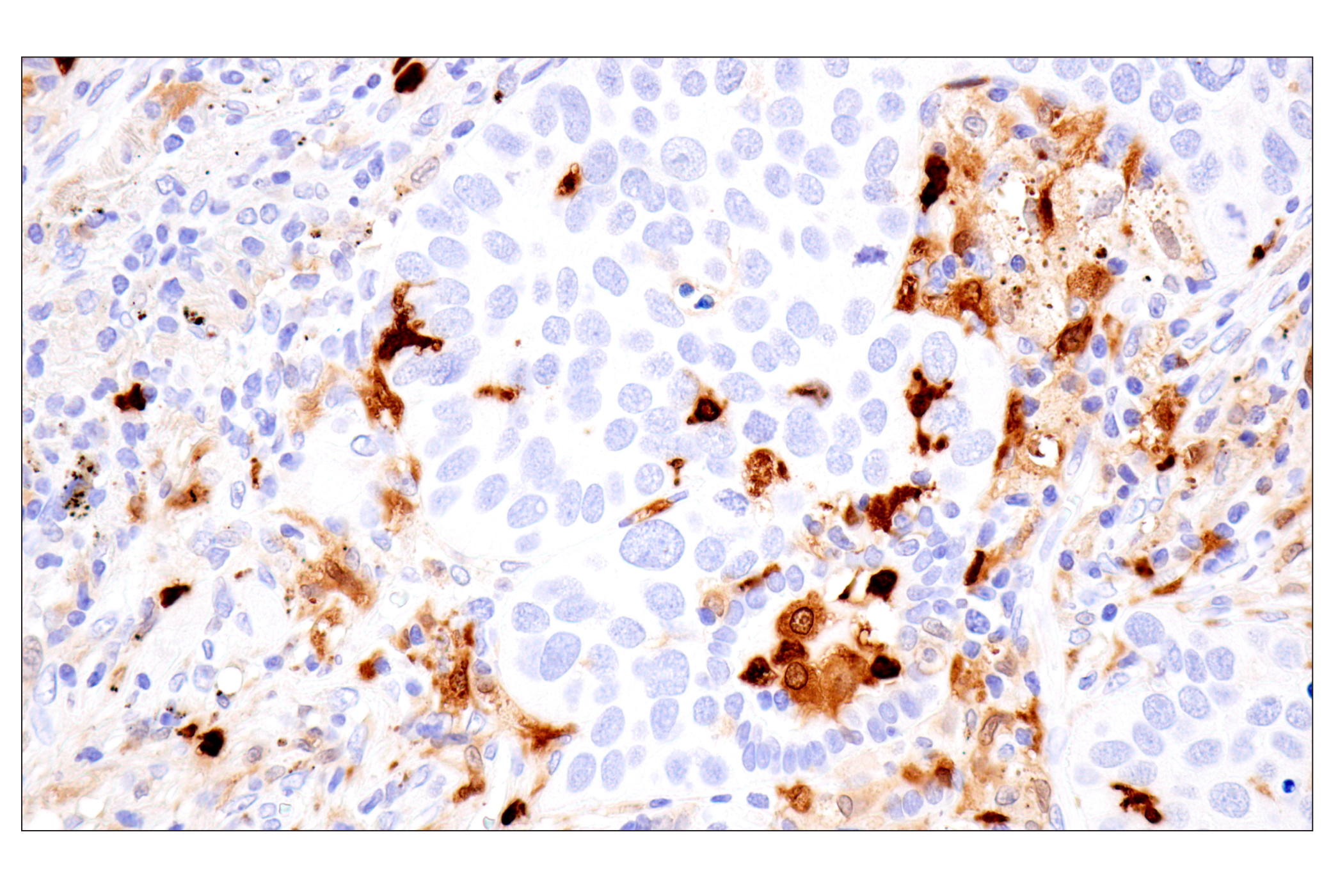 Immunohistochemistry Image 5: S100A8 (F4R2W) Rabbit mAb (BSA and Azide Free)