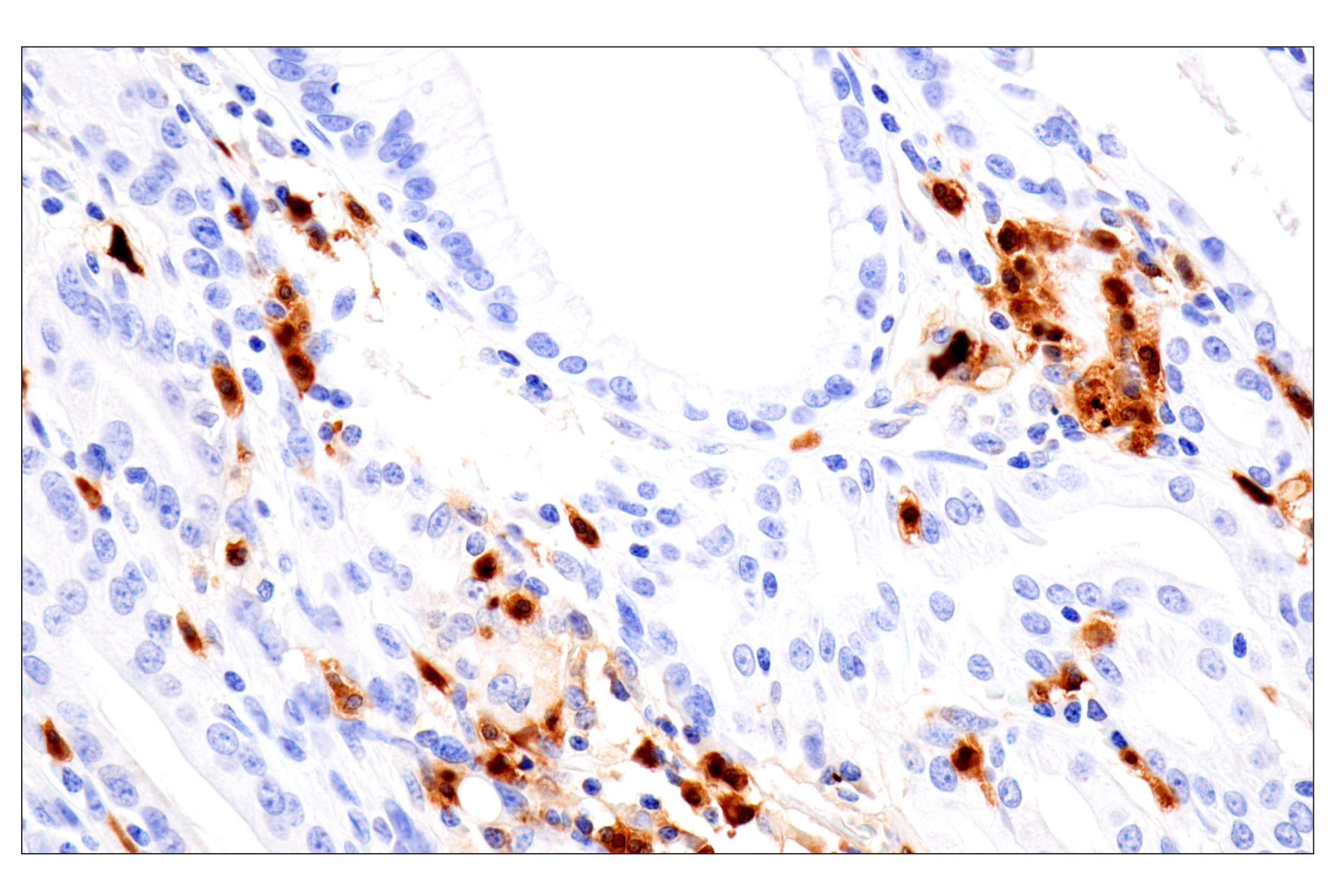 Immunohistochemistry Image 2: S100A8 (F4R2W) Rabbit mAb (BSA and Azide Free)