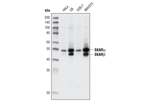 Western Blotting Image 1: SKAR α/β Antibody