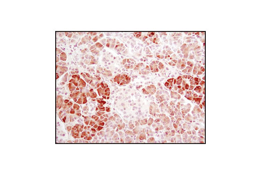 Immunohistochemistry Image 1: α-Amylase (D55H10) XP® Rabbit mAb
