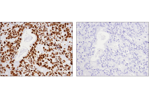 Immunohistochemistry Image 1: Mouse (E1D5H) mAb IgG3 Isotype Control