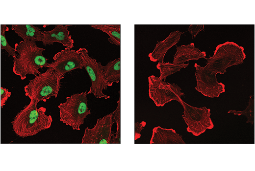 Immunofluorescence Image 3: Mouse (E1D5H) mAb IgG3 Isotype Control