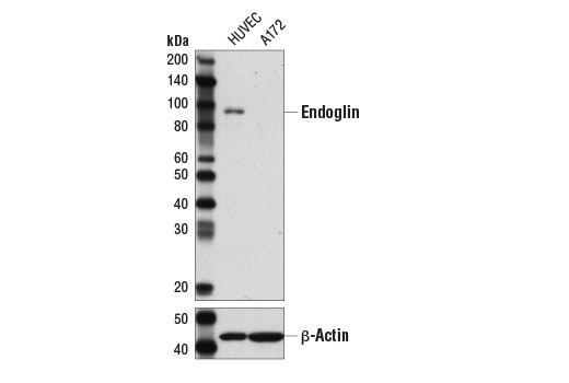 Western Blotting Image 1: CD105/Endoglin (3A9) Mouse mAb (BSA and Azide Free)