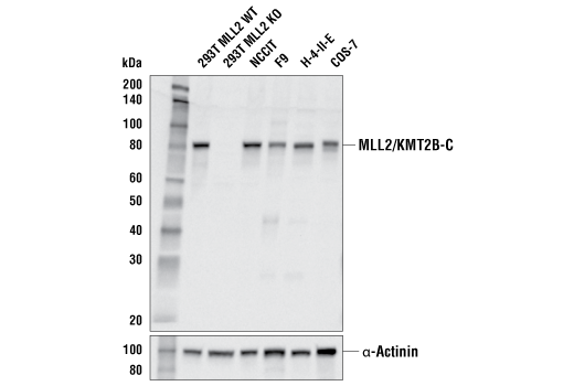 Western Blotting Image 1: MLL2/KMT2B (E6A8V) Rabbit mAb (Carboxy-terminal Antigen)