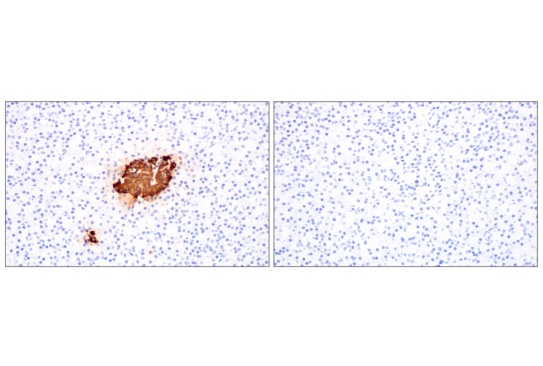Immunohistochemistry Image 1: C-Peptide (E7U7F) XP® Rabbit mAb