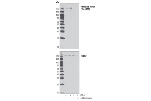  Image 2: PhosphoPlus® Rictor (Thr1135) Antibody Duet
