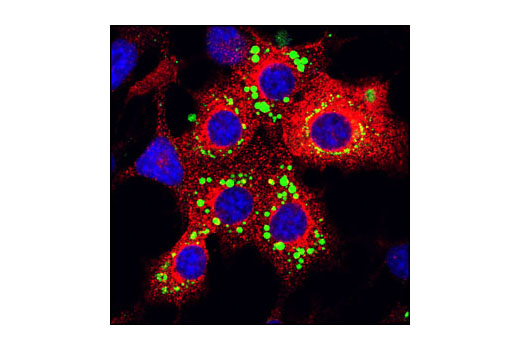 Immunofluorescence Image 1: IRAP Antibody
