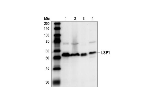 Western Blotting Image 1: LSP1 Antibody
