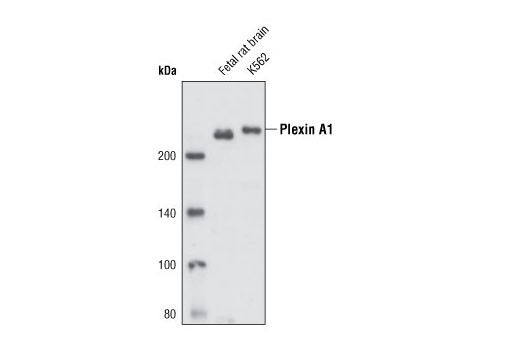 Western Blotting Image 1: Plexin A1 Antibody