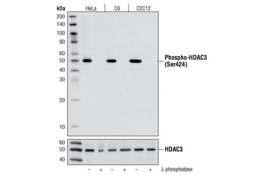 Western Blotting Image 1: Phospho-HDAC3 (Ser424) Antibody