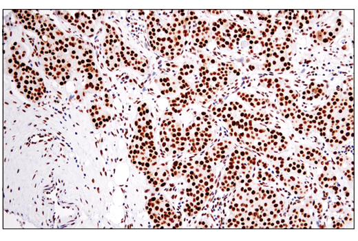 Immunohistochemistry Image 1: DNA-PKcs (E6U3A) Rabbit mAb