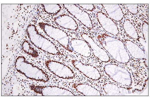 Immunohistochemistry Image 2: DNA-PKcs (E6U3A) Rabbit mAb