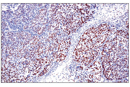 Immunohistochemistry Image 5: DNA-PKcs (E6U3A) Rabbit mAb