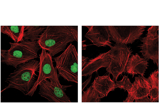 Immunofluorescence Image 1: DNA-PKcs (E6U3A) Rabbit mAb