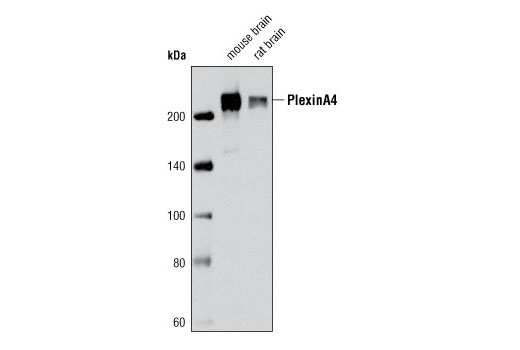  Image 2: Plexin Isoform Antibody Sampler Kit