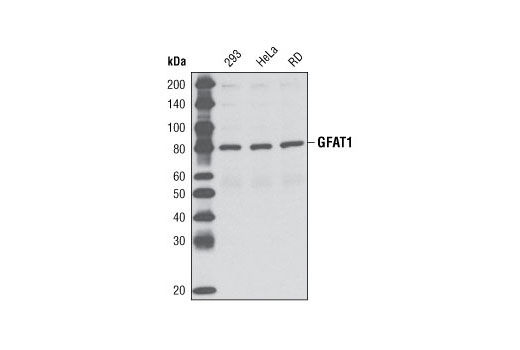Western Blotting Image 1: GFAT1 Antibody
