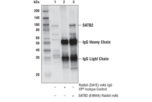 Immunoprecipitation Image 1: SATB2 (E4N4A) Rabbit mAb