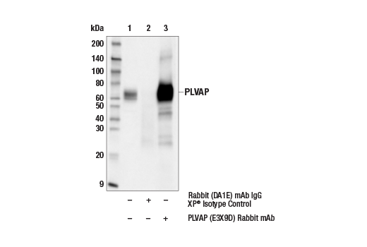 Immunoprecipitation Image 1: PLVAP (E3X9D) Rabbit mAb
