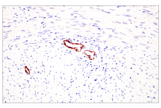 Immunohistochemistry Image 9: PLVAP (E3X9D) Rabbit mAb